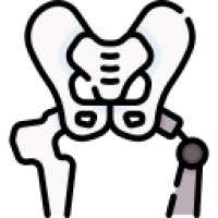 جراحة استبدال مفصل الورك